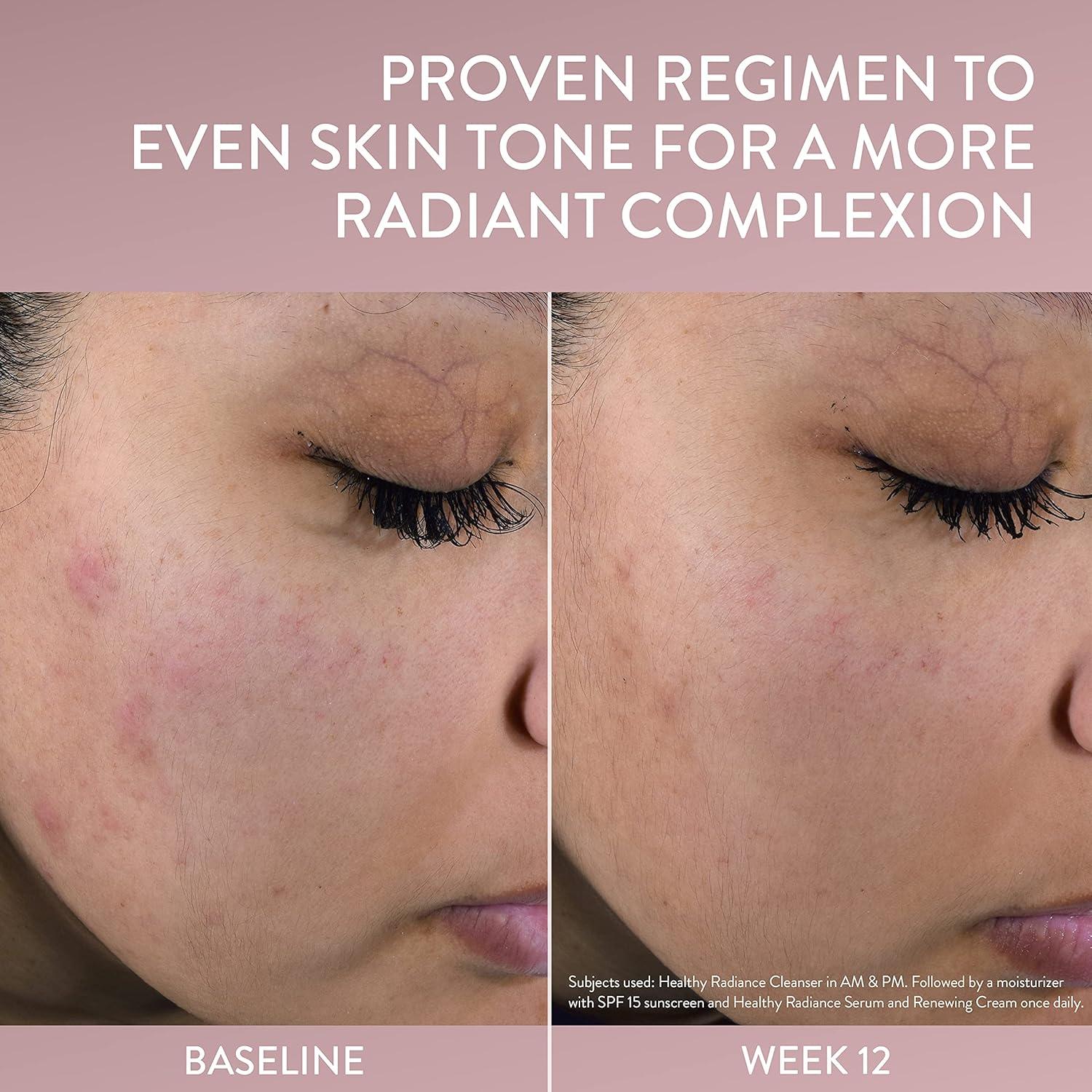 Cetaphil Limpiador Facial Exfoliante Suave 119g Piel Sensible