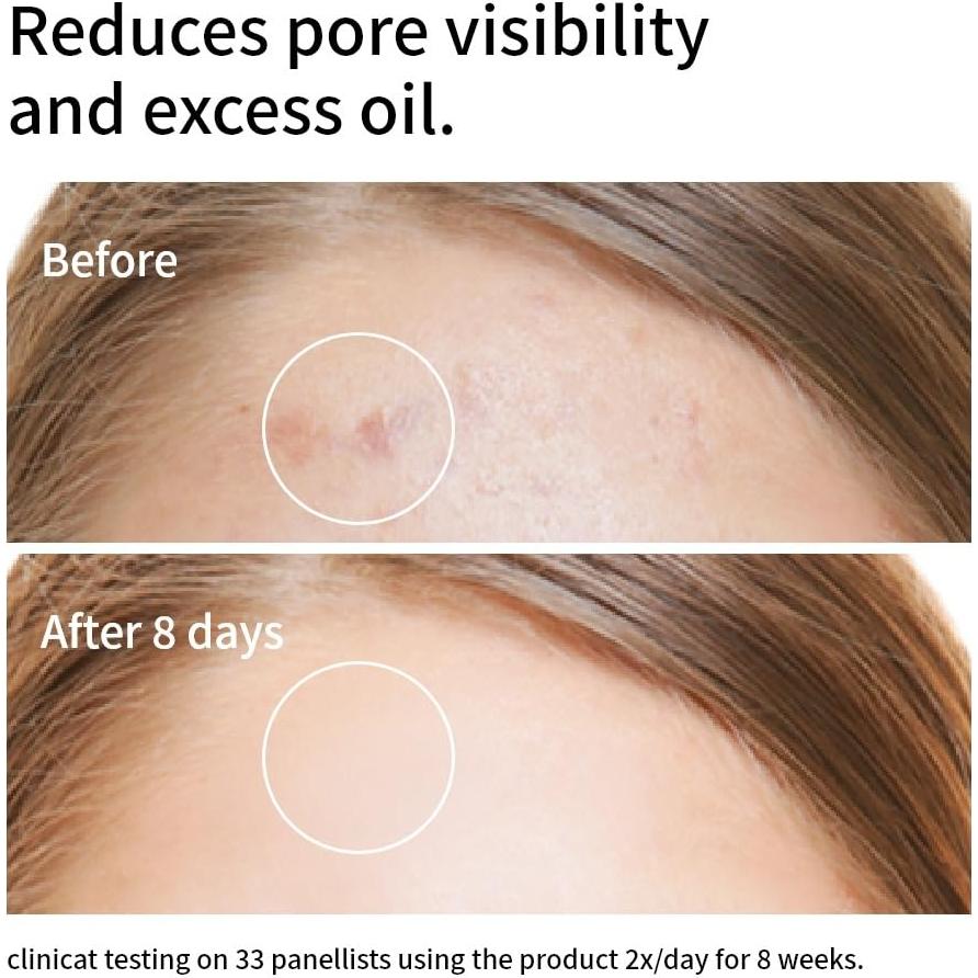 Suero Facial Niacinamida 10% + Zinc 1% XMEECOS 30ml