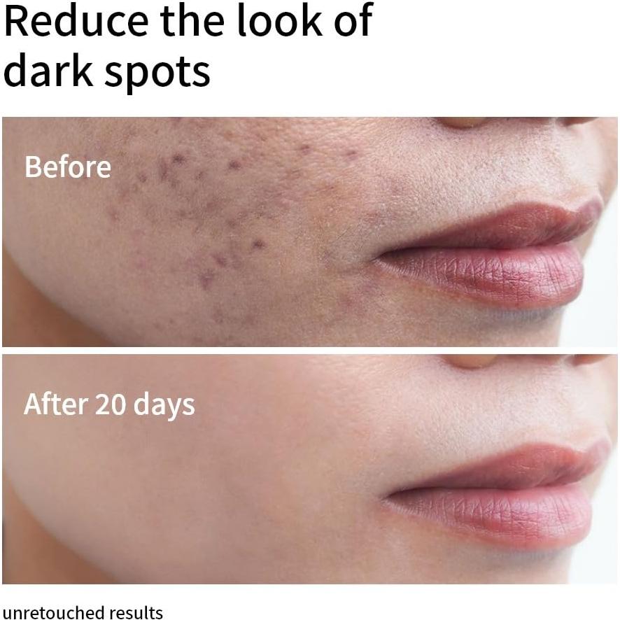 Suero Facial Niacinamida 10% + Zinc 1% XMEECOS 30ml