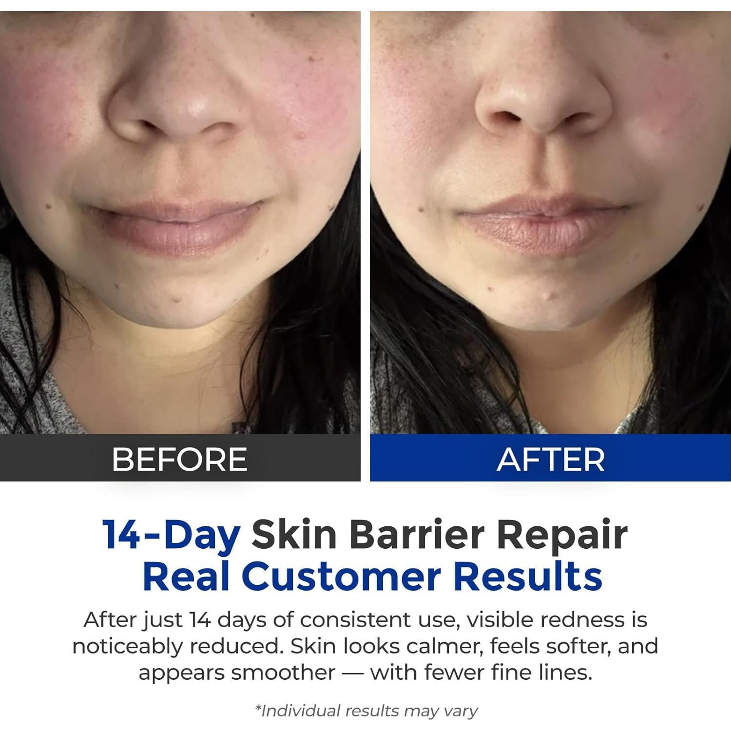 Set de 3 Esencias Skinerse - Sueros Antiarrugas y Calmantes