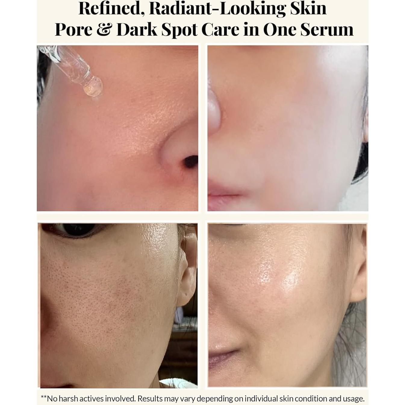 Suero de Niacinamida 15% Coreano - Vitamina C y Glutación