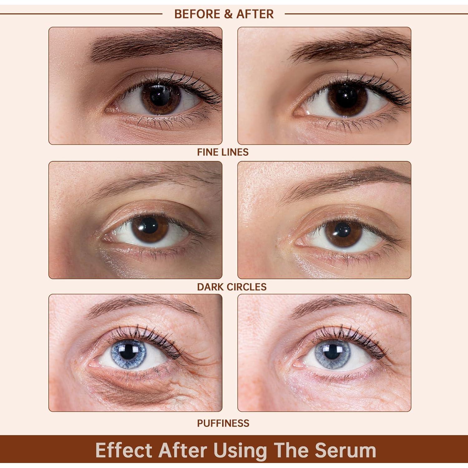 Suero para Ojos CHANGARLOAD 30ml Cafeína 5% Hidratante