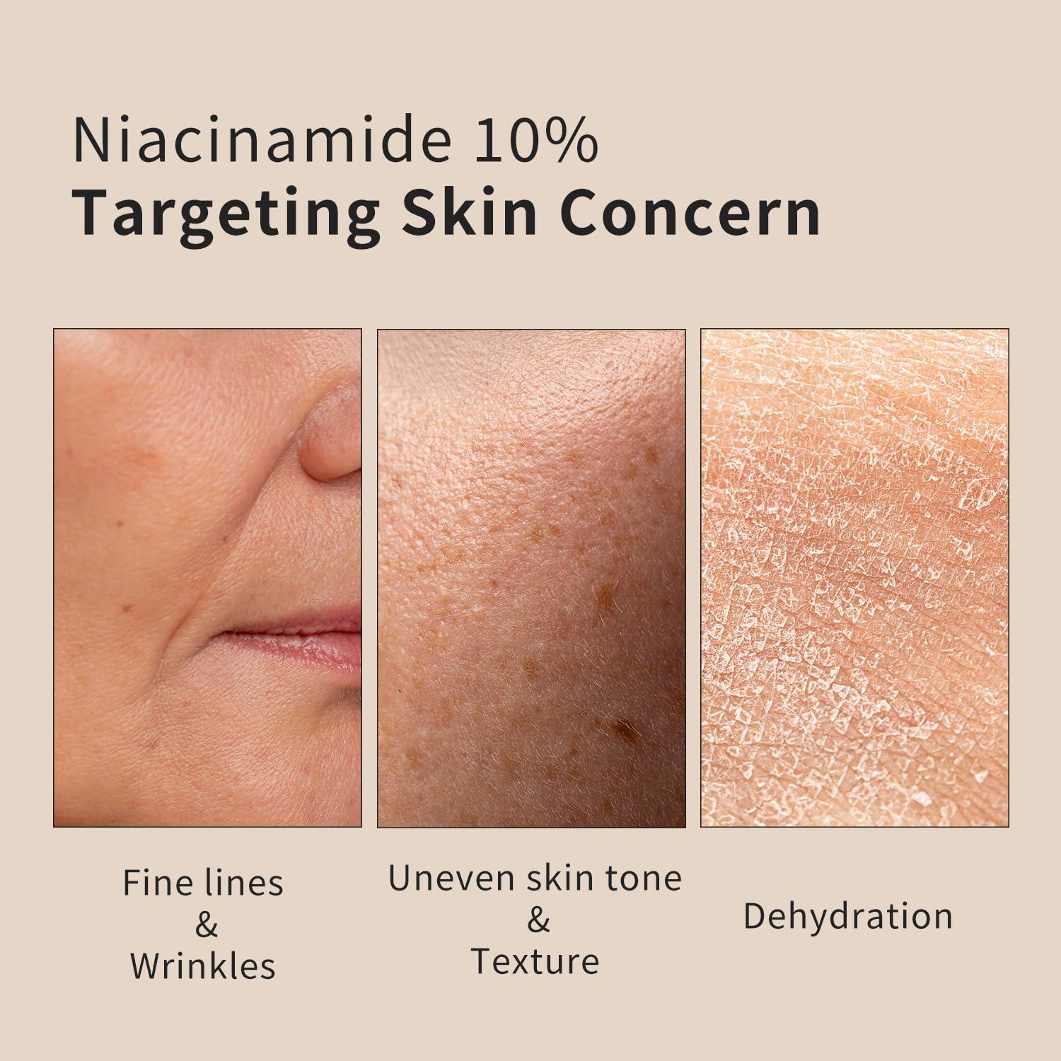 Suero Antienvejecimiento Epielle 10% Niacinamida 88.72 ml