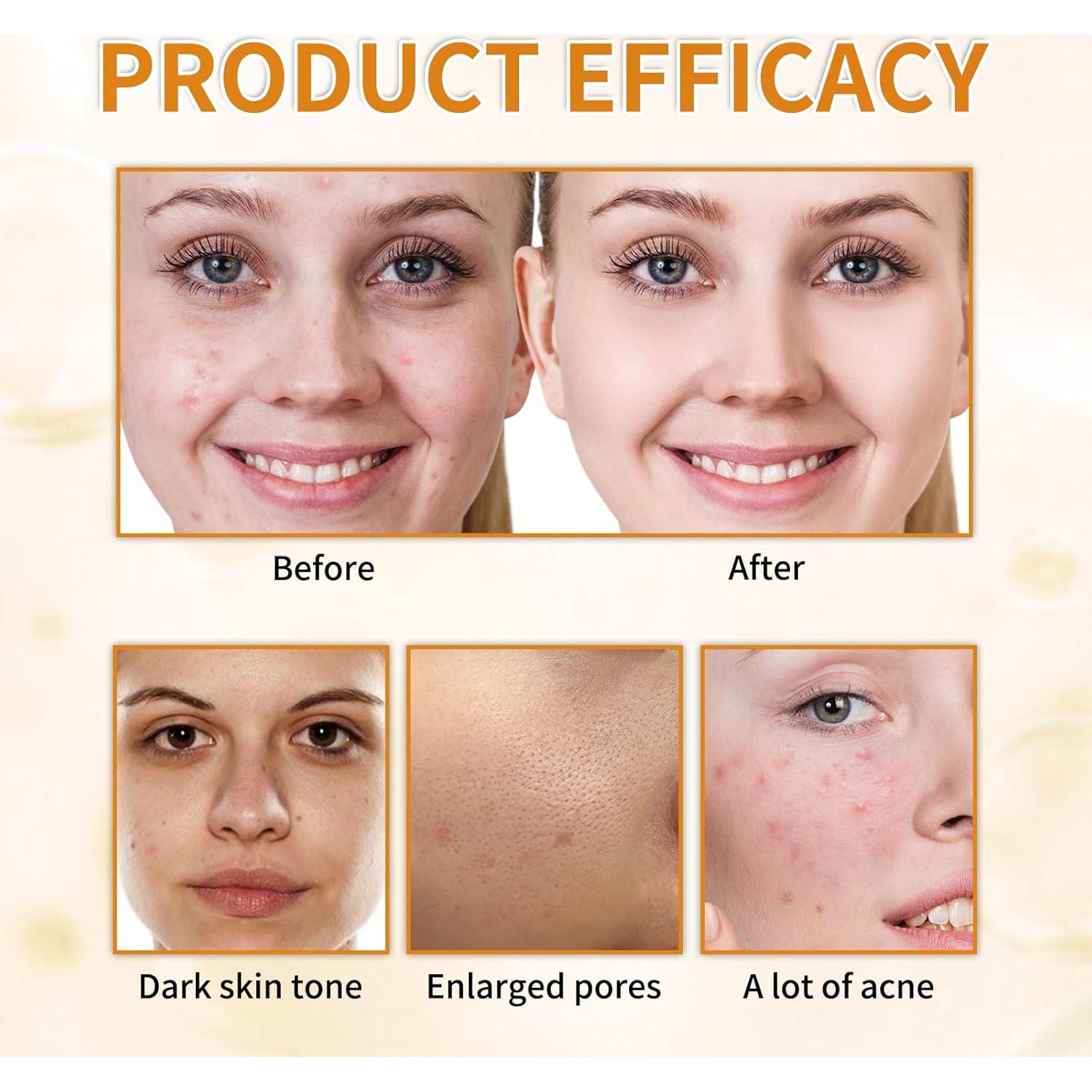 Tónico Exfoliante Facial Sokgo 249.84 ml Ácido Glicólico 7%