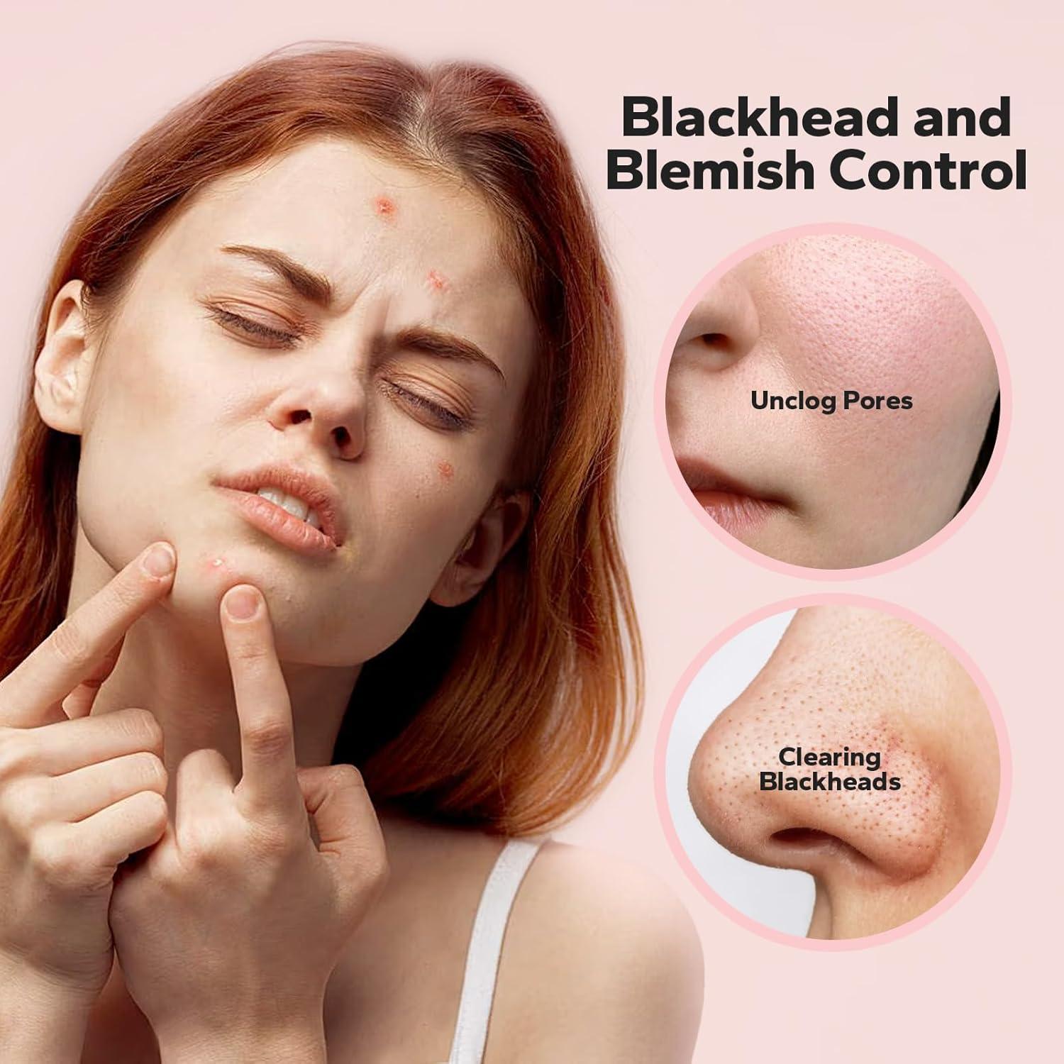 Suero Facial SilkyShark 30 ml - 10% Niacinamida + 4% TXA