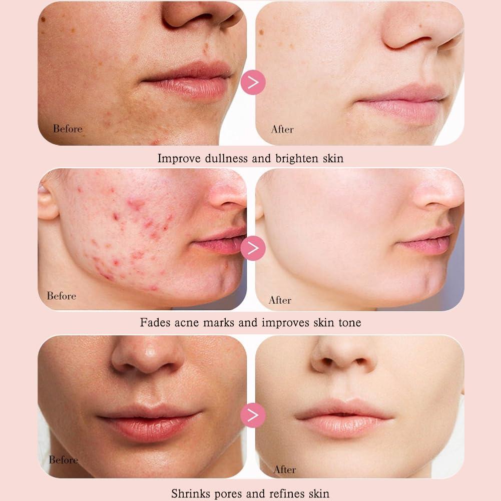 Suero Facial de Niacinamida 70% Durazno COSMOO 40g