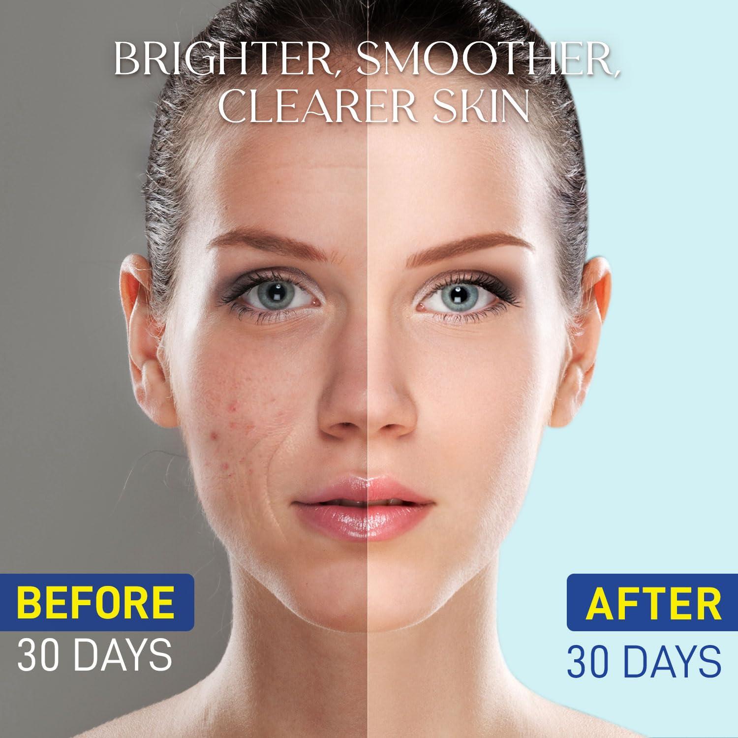 Suero de Niacinamida 15% Enaskin Naturals 50 ml - Iluminador y Control de Aceite