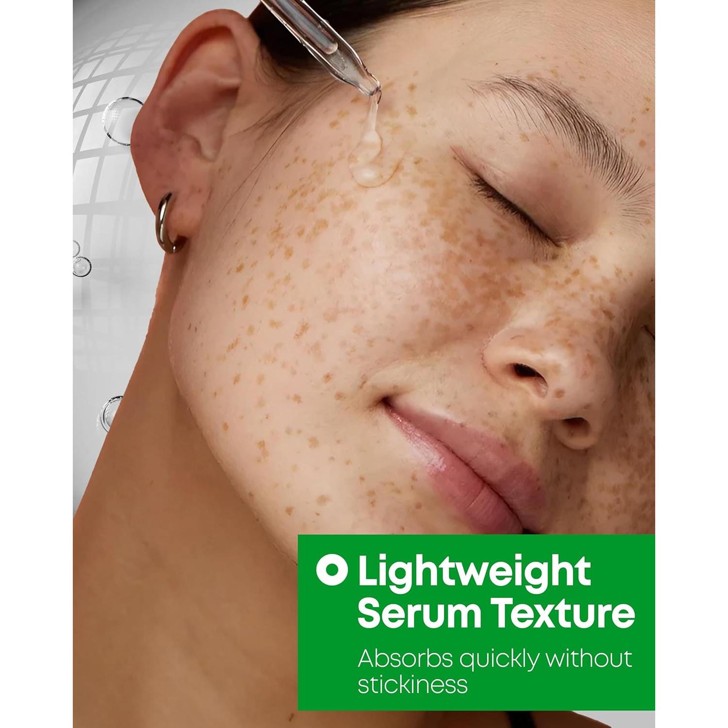 Suero A-Control 10% Ácido Azelaico 30 ml - Tratamiento Acné