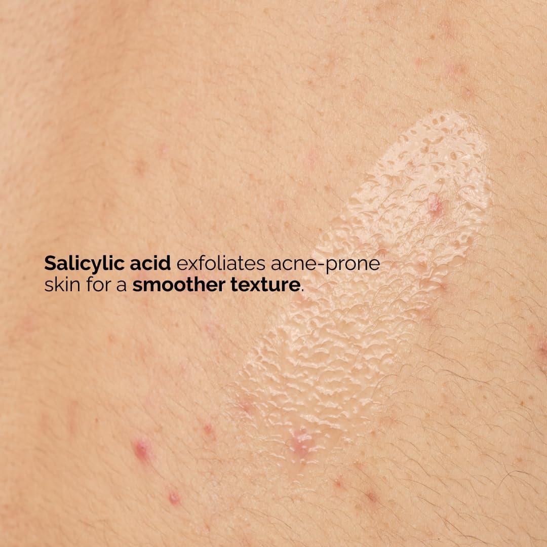 El Ordinario Suero Corporal Ácido Salicílico 0.5% 240 ml