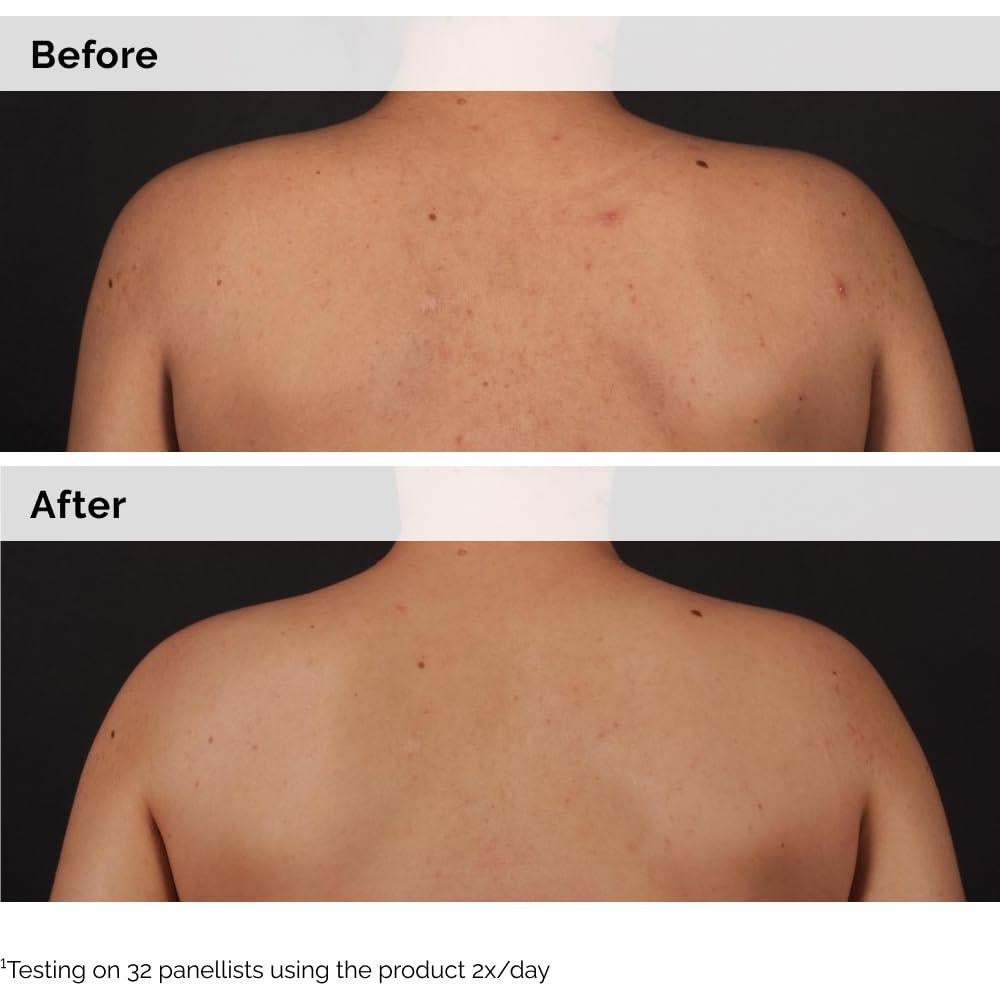 El Ordinario Suero Corporal Ácido Salicílico 0.5% 240 ml