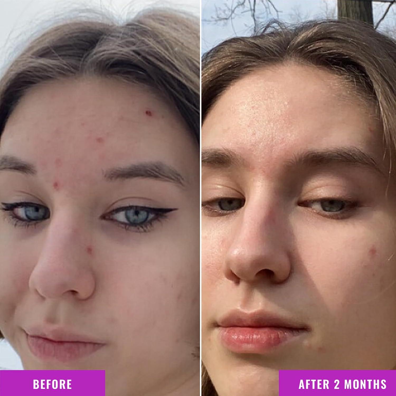 Suero de Niacinamida 10% Good Molecules - Hidratante Facial