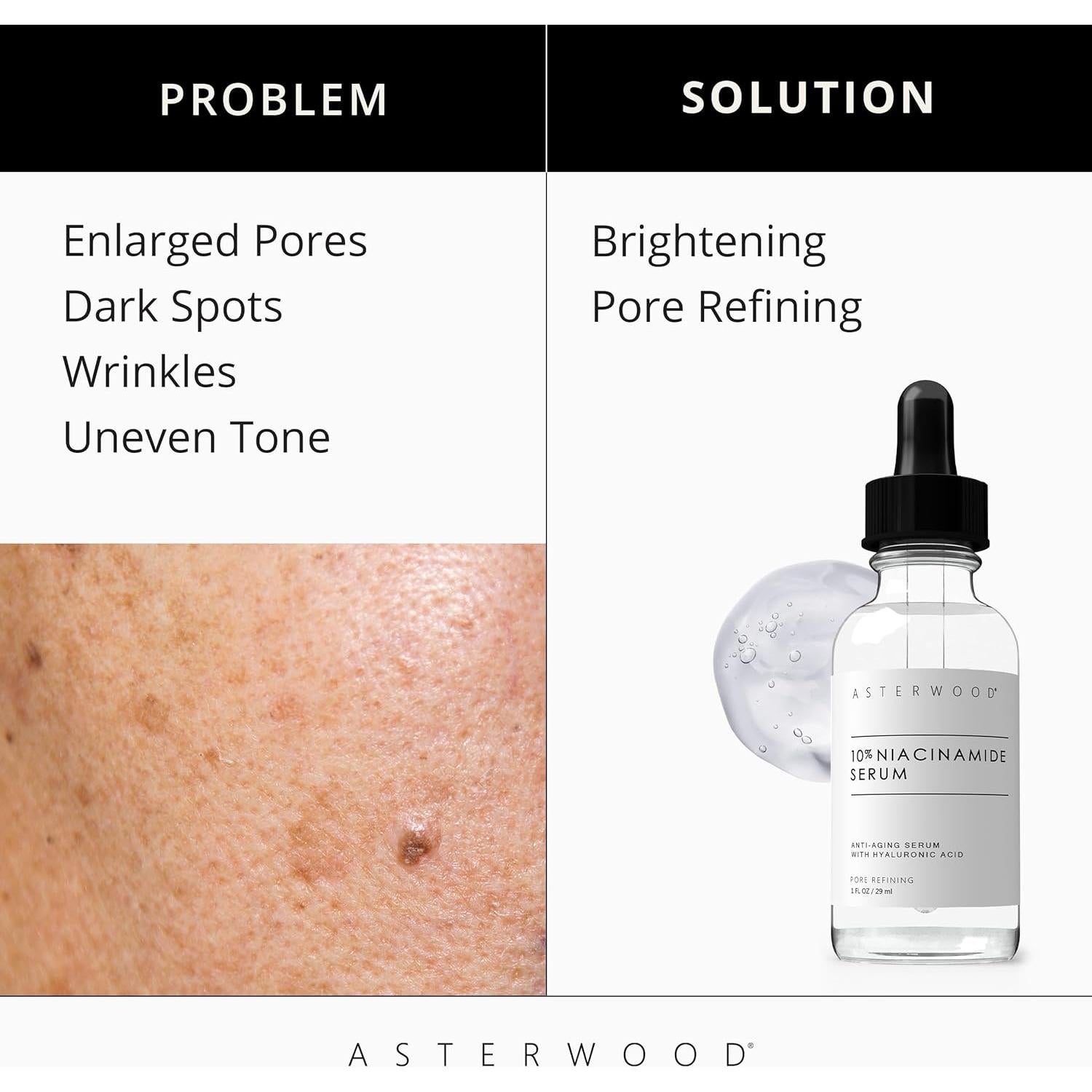 Suero de Niacinamida 10% Asterwood 29.57 ml - Hidratante Antienvejecimiento