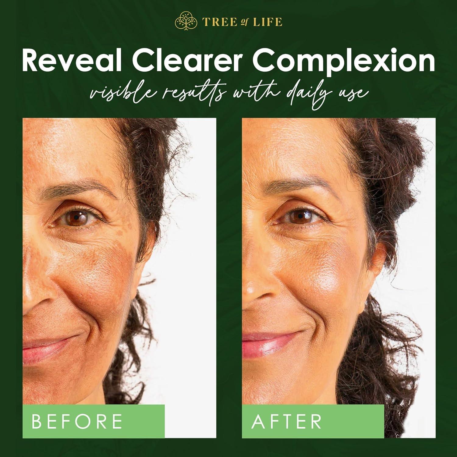 Suero de Niacinamida Tree of Life 59.15 ml - Hidratante Facial