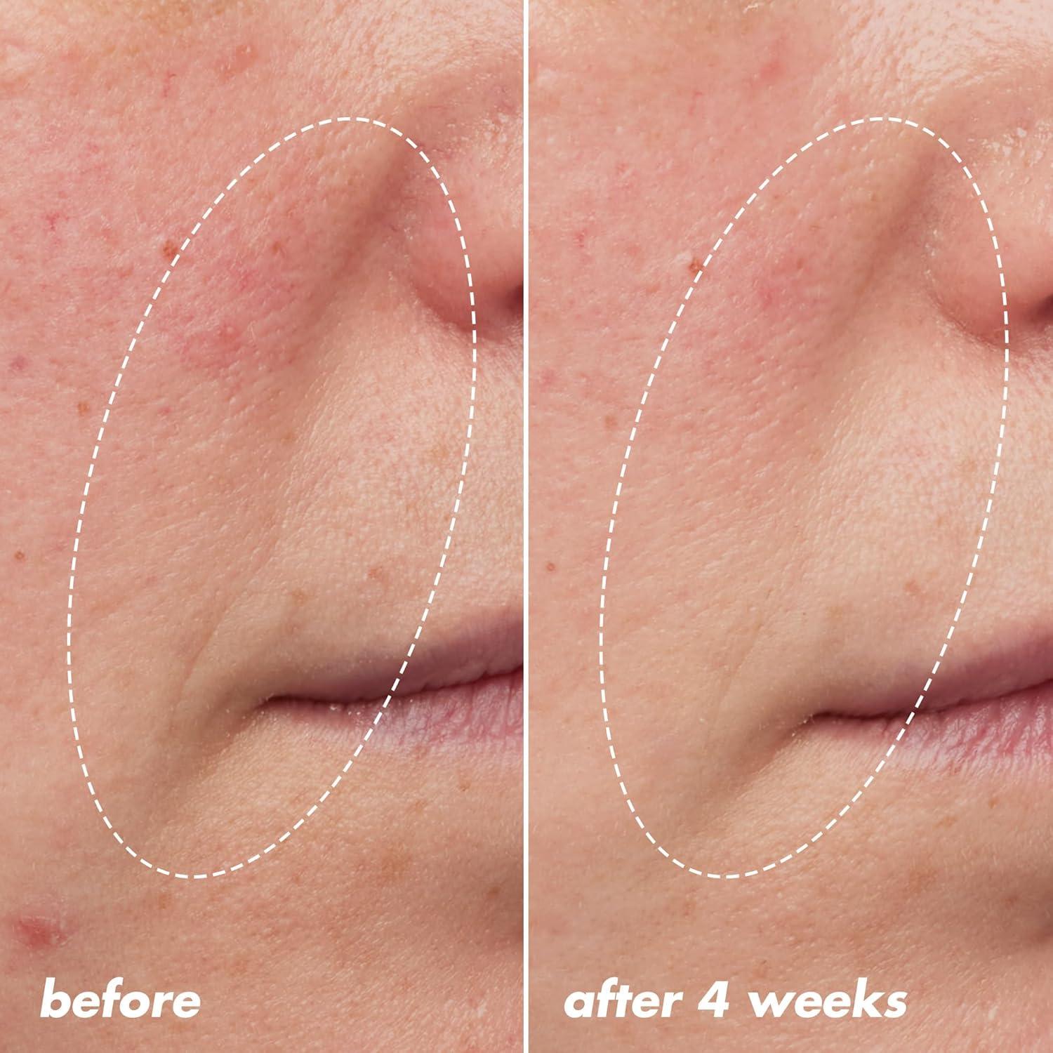 e.l.f. SKIN Aceite Nocturno Blue-ty Sleep 30ml - Antiarrugas Vegano