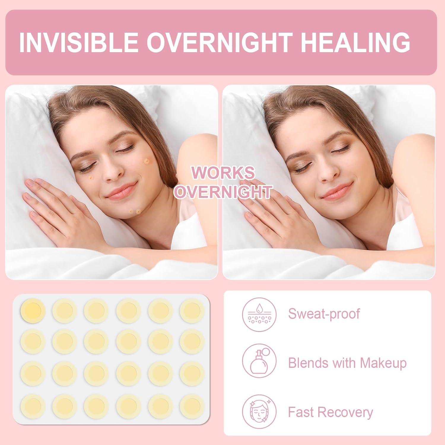 Kit de Parches para Acné Vathery - 3 Pasos, 9 Parches Microdart y 24 Hidrocoloides