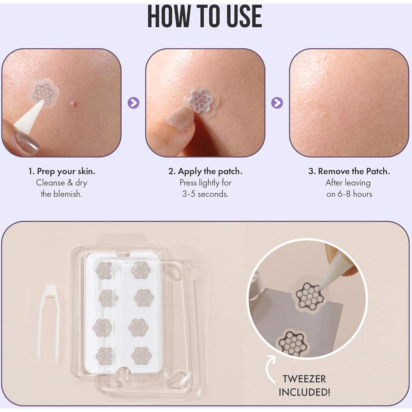 Microagujas para Acné LAFLARE 6 Piezas - Acción Rápida