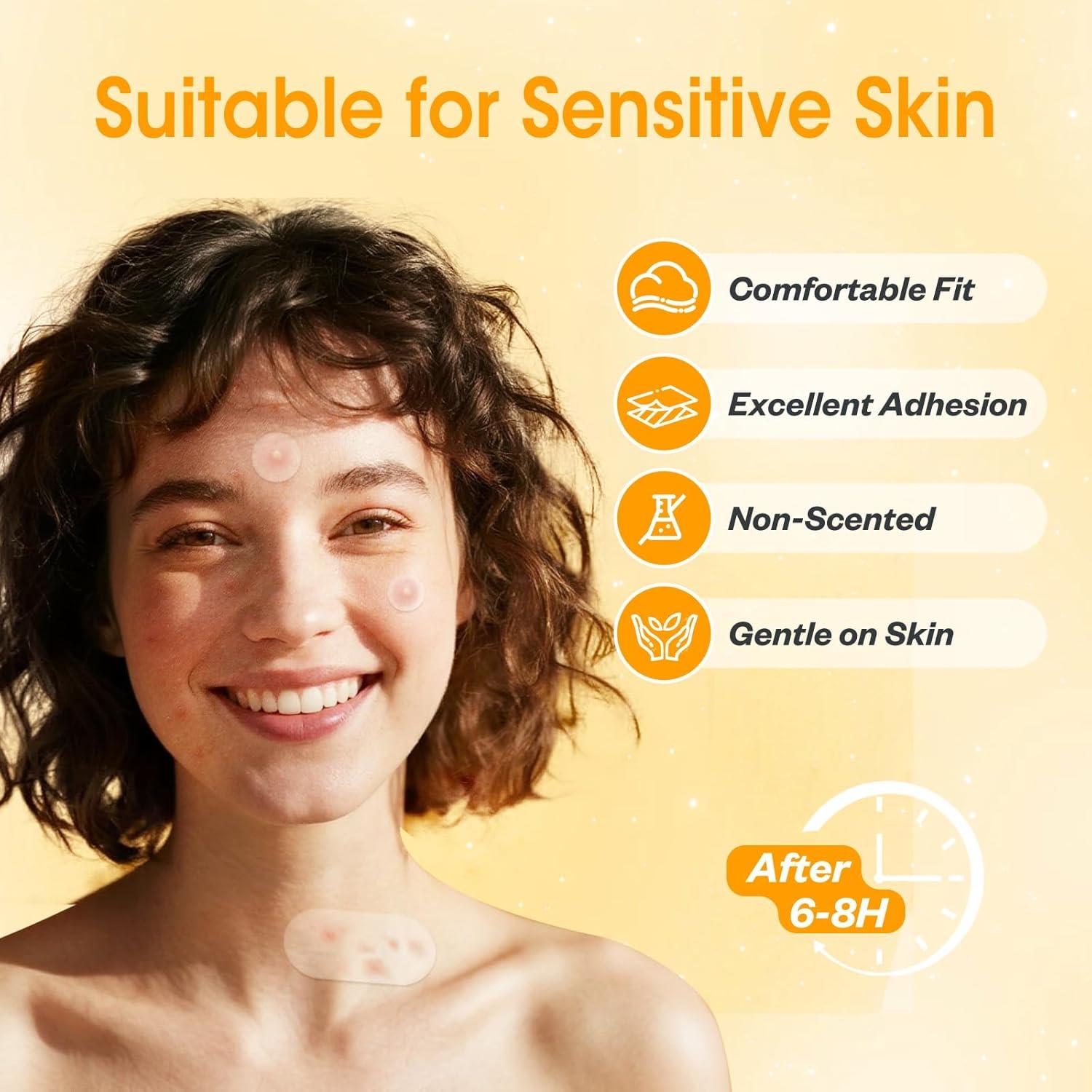 Parche Hidrocoloide para Granos JOLVKA - 368 Unidades, 5 Tamaños