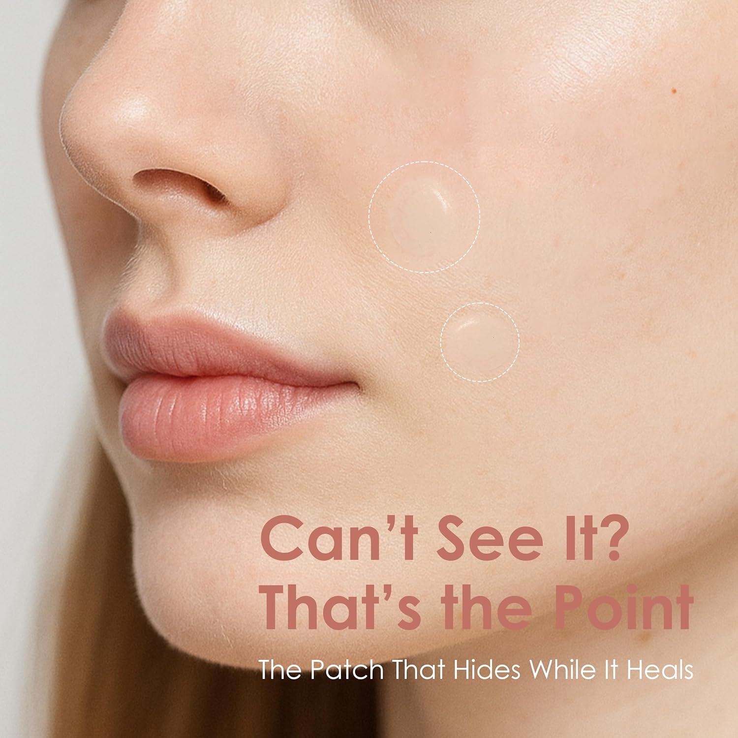 Parche Aliviador de Manchas Activas ASAP - 39 Parches Hidrocoloide