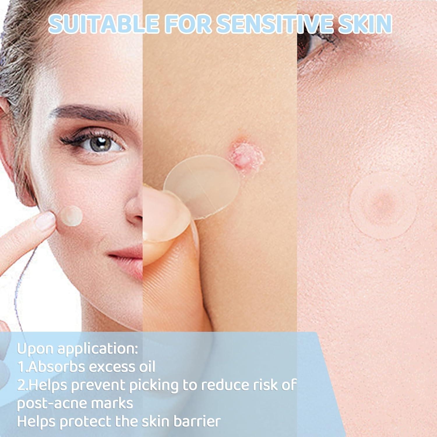 Parche Hidrocoloide para Granos FUANKANG - 104 Unidades con Espejo