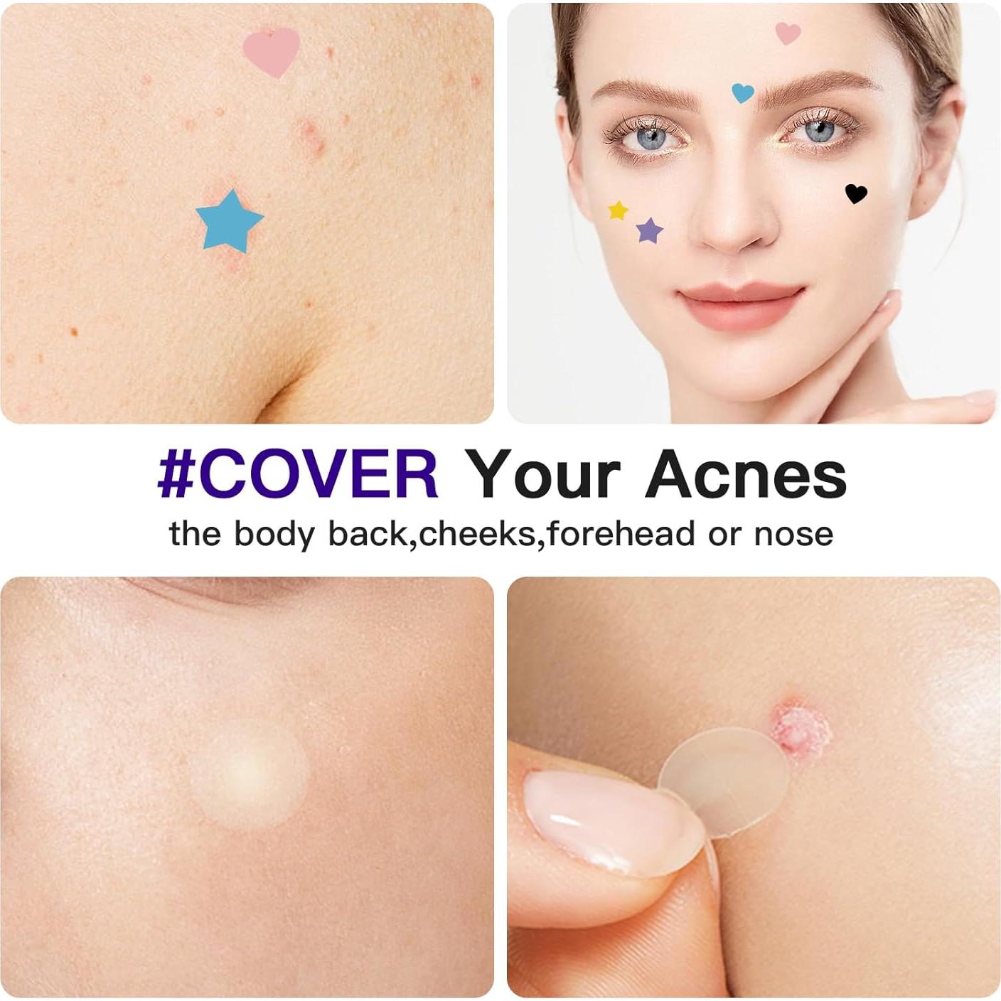 Parches para Acné Hidrocoloide 312CT - Ácido Salicílico, 5 Tamaños, 6 Colores