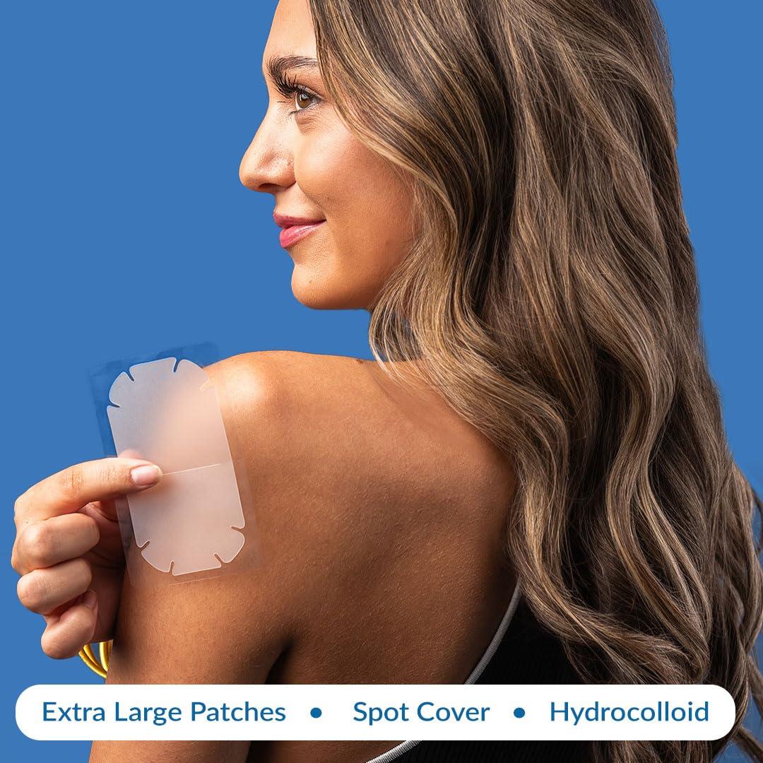 Parches para Granos Extra Grandes EZACNE - Hidrocoloide Médico (5 Unidades)