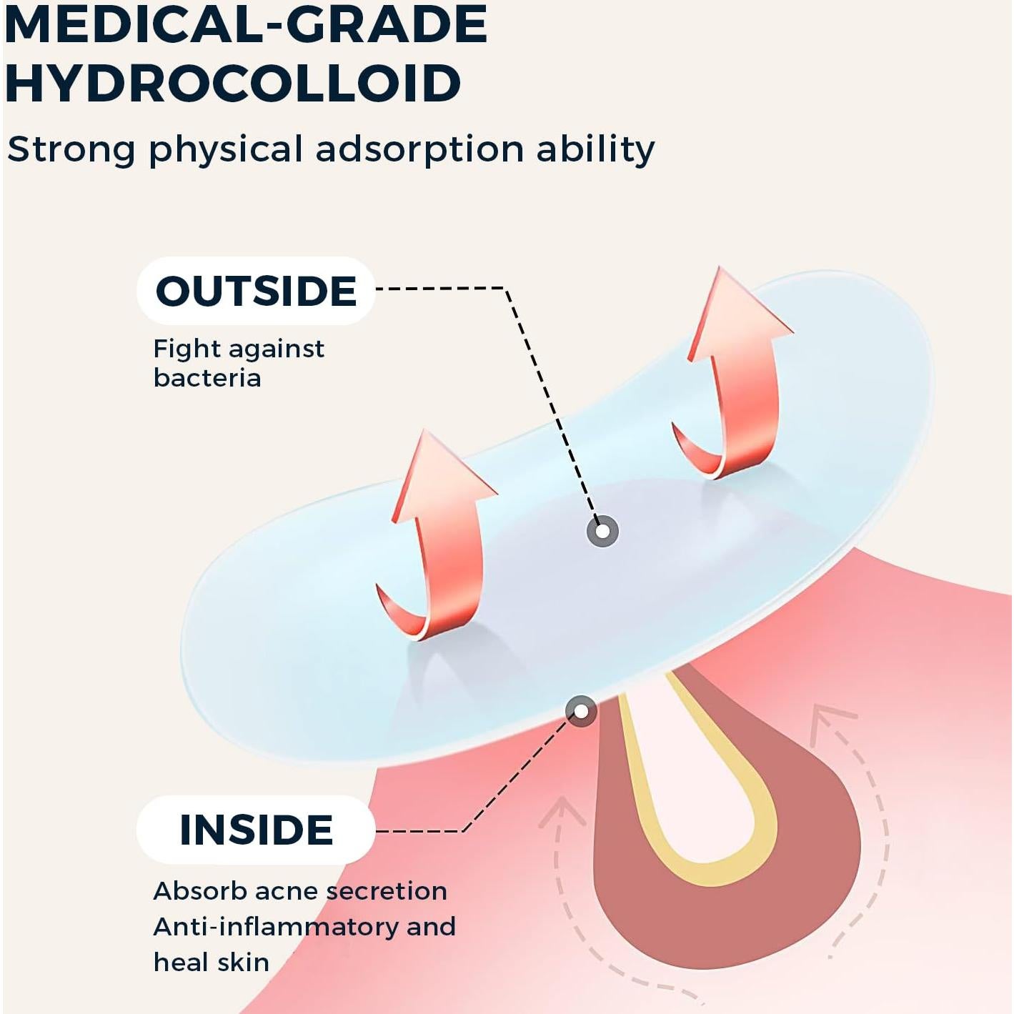 Parche Hidrocoloide para Granos Havenique - 324 Unidades
