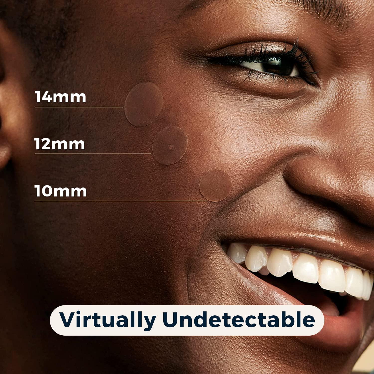 Parche Hidrocoloide para Granos Havenique - 324 Unidades