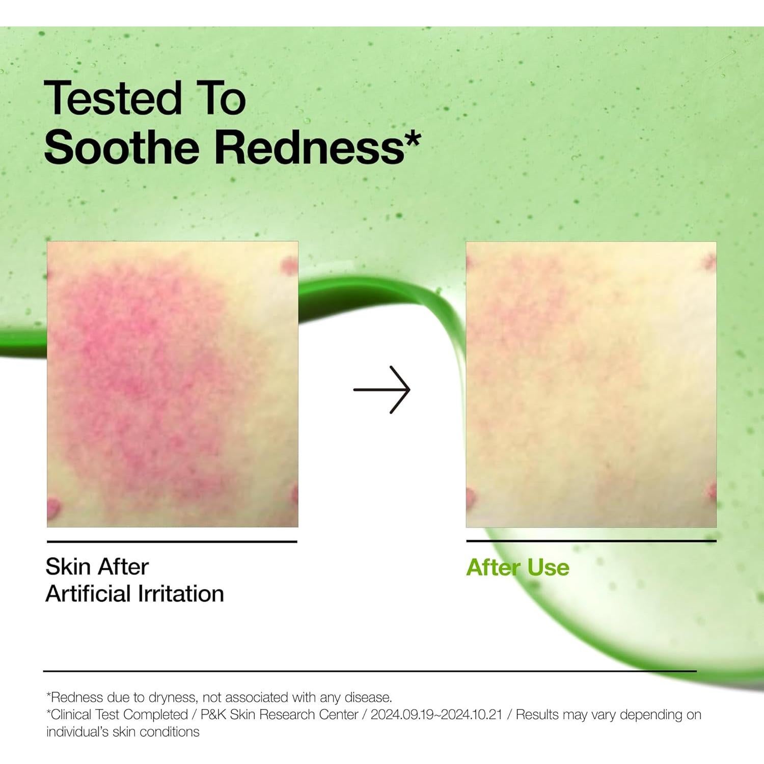 Set de Cuidado de Piel Anua Ultimate Spot Duo - Niacinamida 10% y Ácido Azelaico 10%