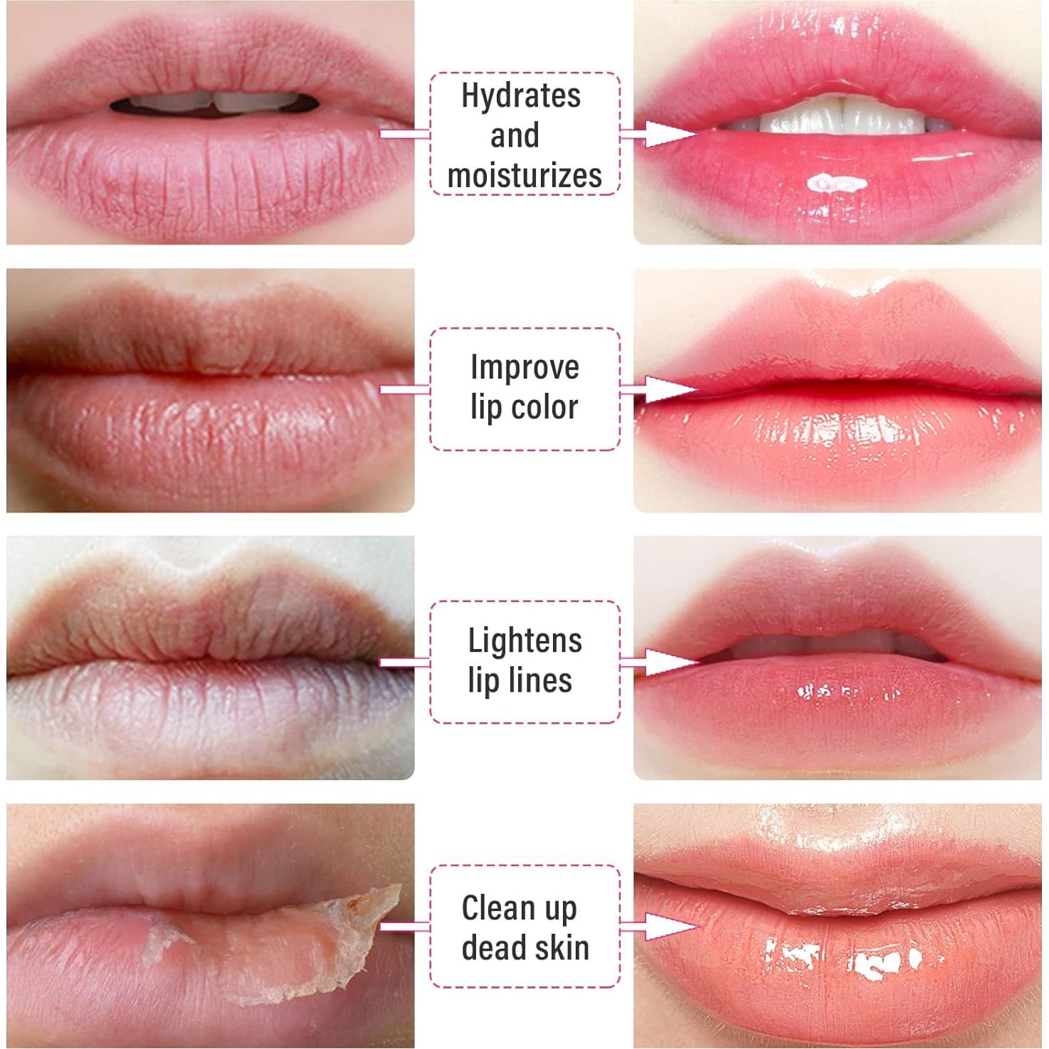 Mascarilla Labial Colágeno Reengull 30 Piezas Hidratante