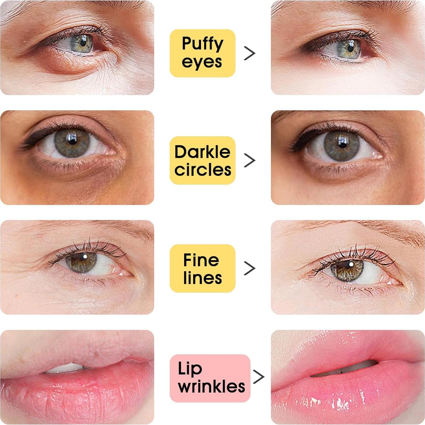 40 Piezas Máscaras de Colágeno para Ojos y Labios Adofect