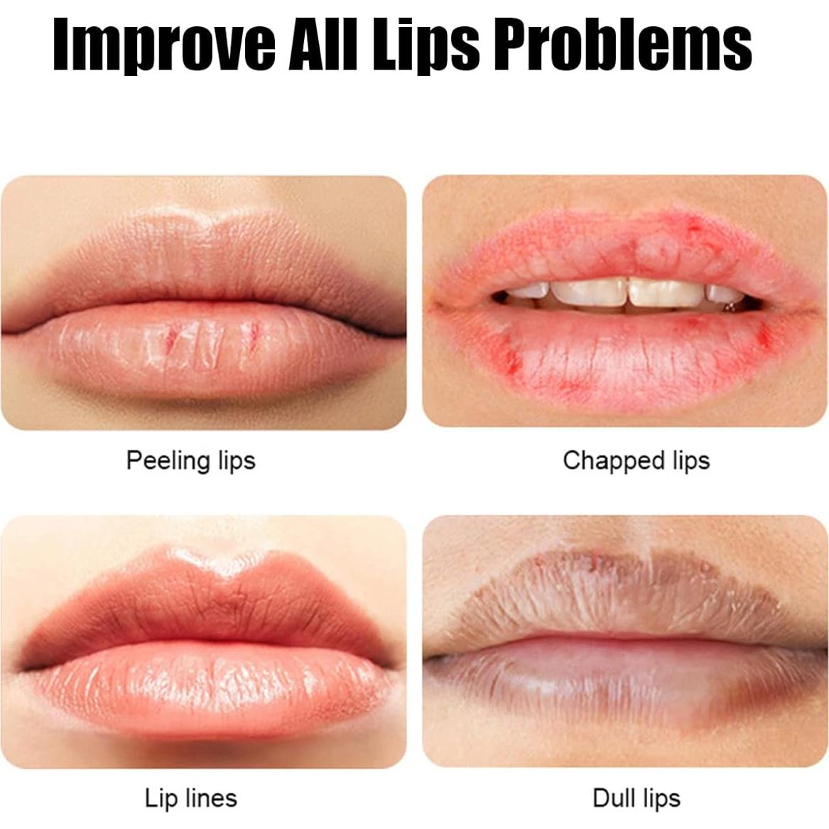 Mascarilla Labial de Oro 24K Veronni - 30 Piezas Hidratantes