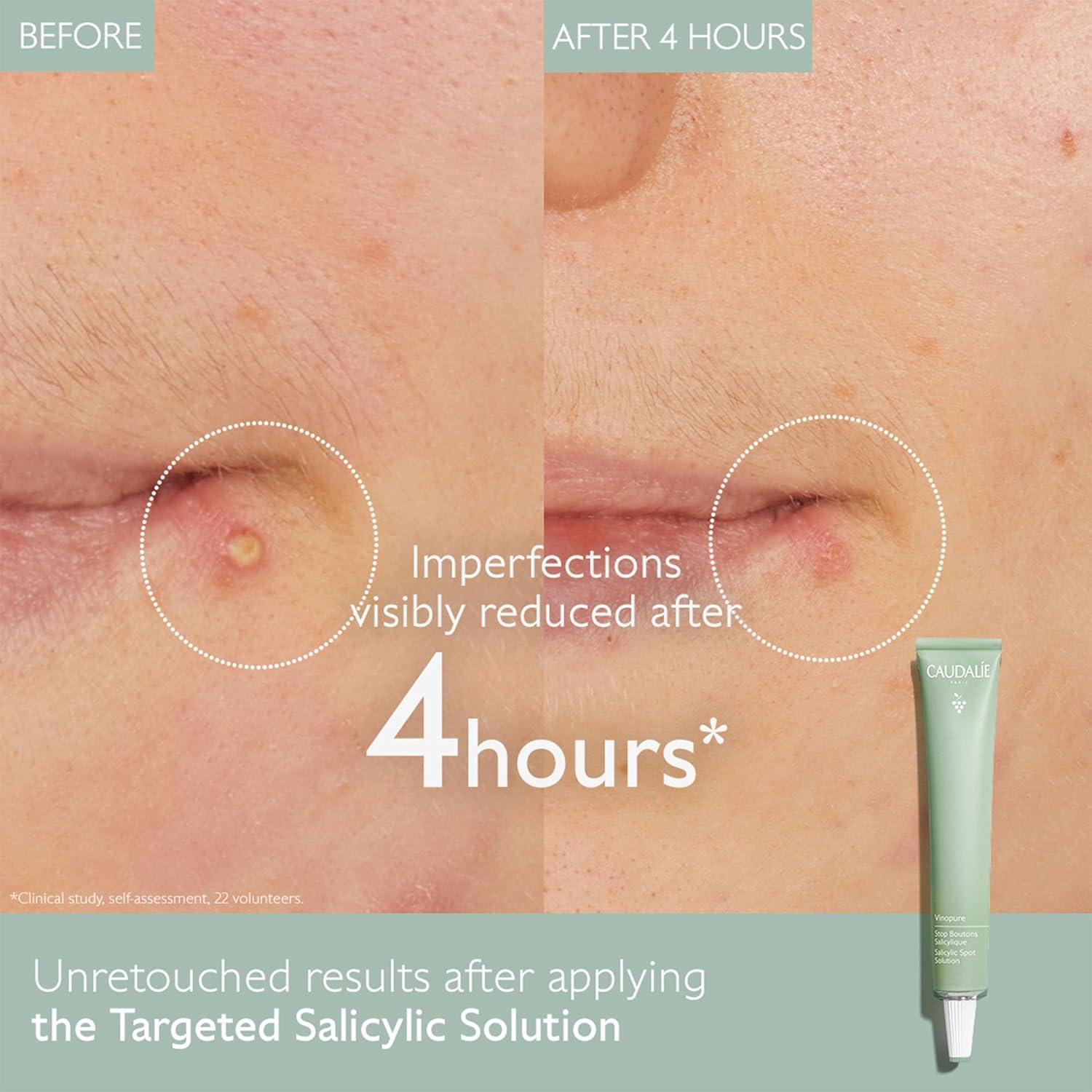 Caudalie Vinopure Solución Correctora de Manchas 15 mL