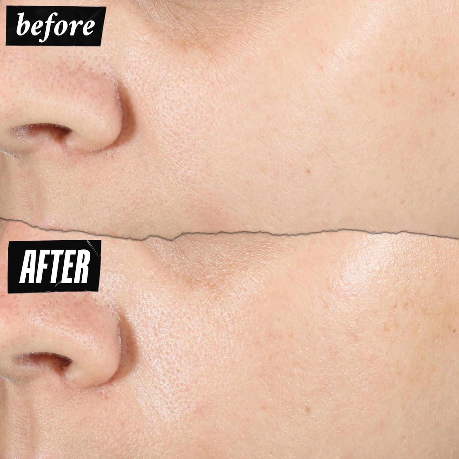 Sérum Facial Ácido Hialurónico Kiehl's 1.5% 29.57 ml