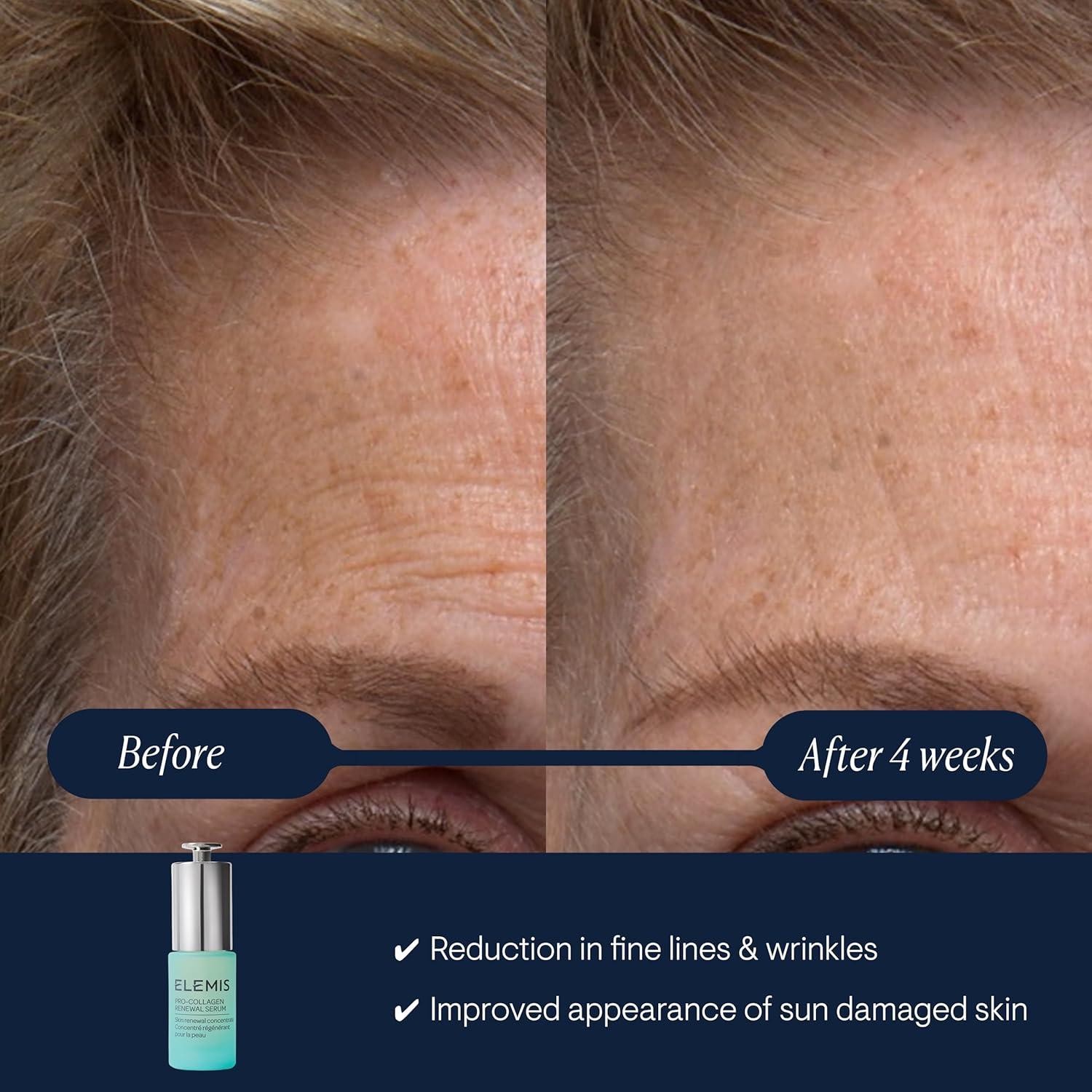 Suero de Renovación Pro-Collagen ELEMIS 15ml - Suave Alternativa al Retinol