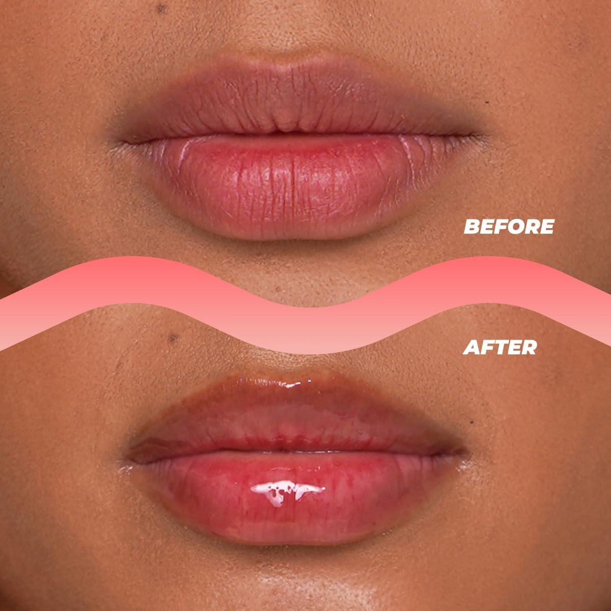 Aceite Labial Hidratante Vitamasques Sandía 5 ml - No Pegajoso