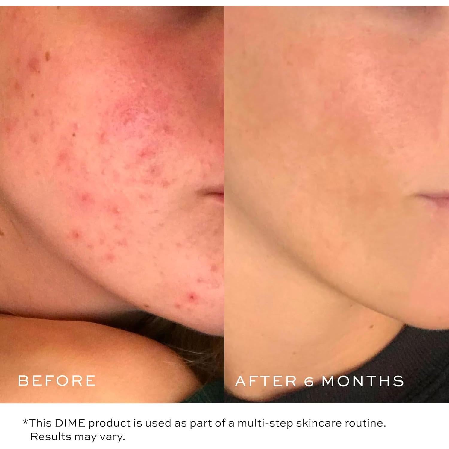 Limpiador Facial Suave DIME Beauty 120 ml con Vitamina E