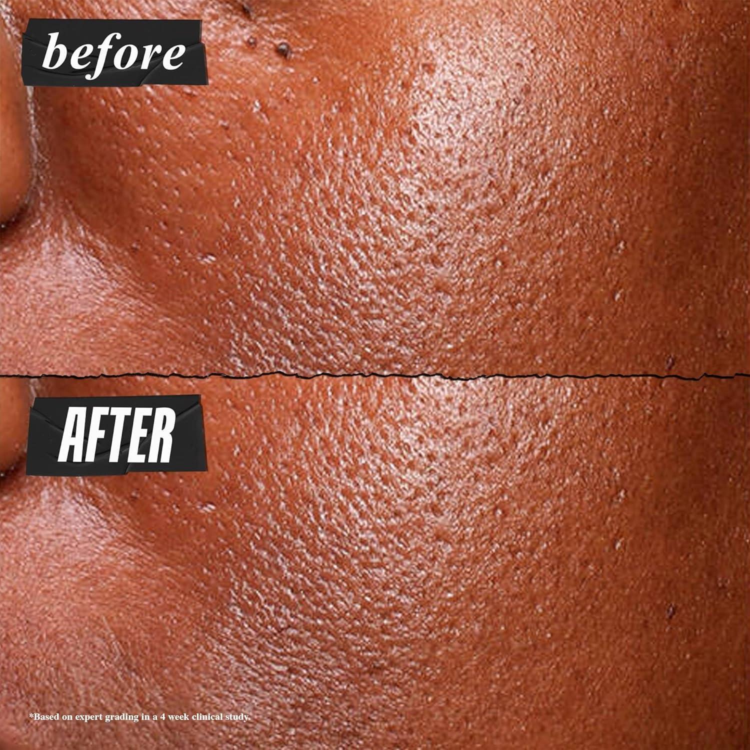 Suero Facial Niacinamida 5% Kiehl's 29.57 ml Piel Grasa