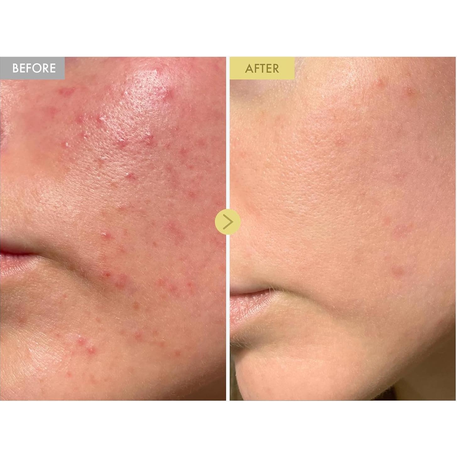 Crema Facial Tosowoong de Mucina de Caracol Negra 100ml