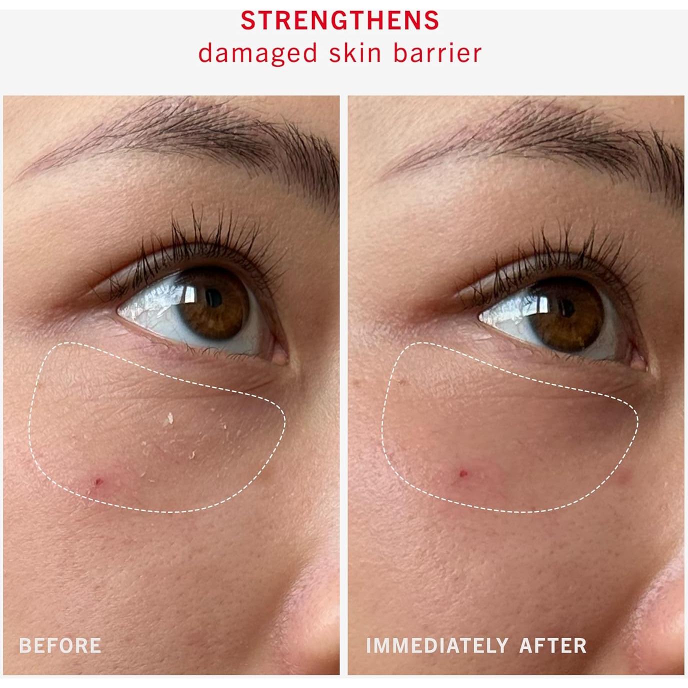 Bálsamo Barrera Ultra Reparador First Aid Beauty 63.5 g