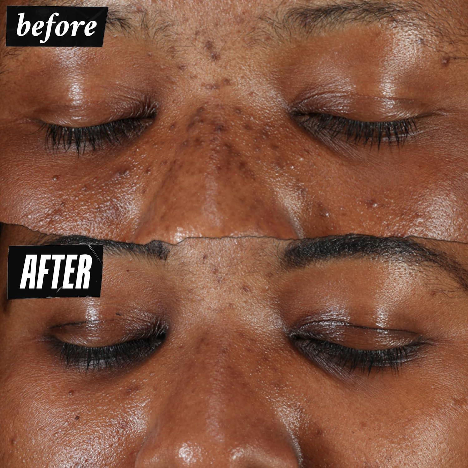 Suero Facial Kiehl's 50 ml Corrector de Manchas Oscuras