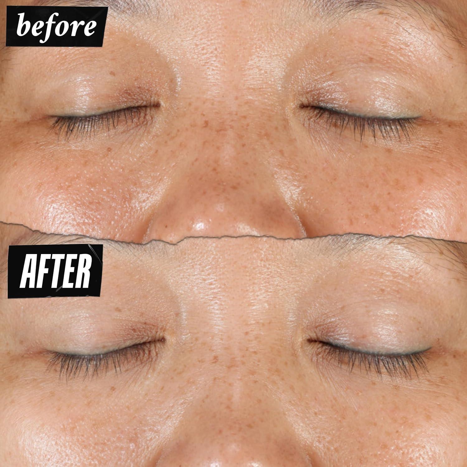 Suero Facial Kiehl's 50 ml Corrector de Manchas Oscuras