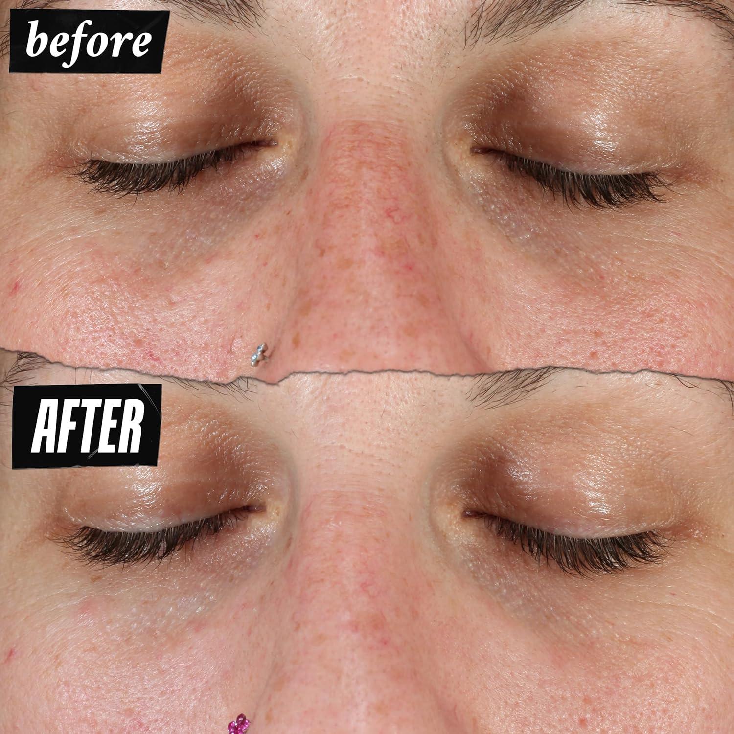 Suero Facial Kiehl's 50 ml Corrector de Manchas Oscuras