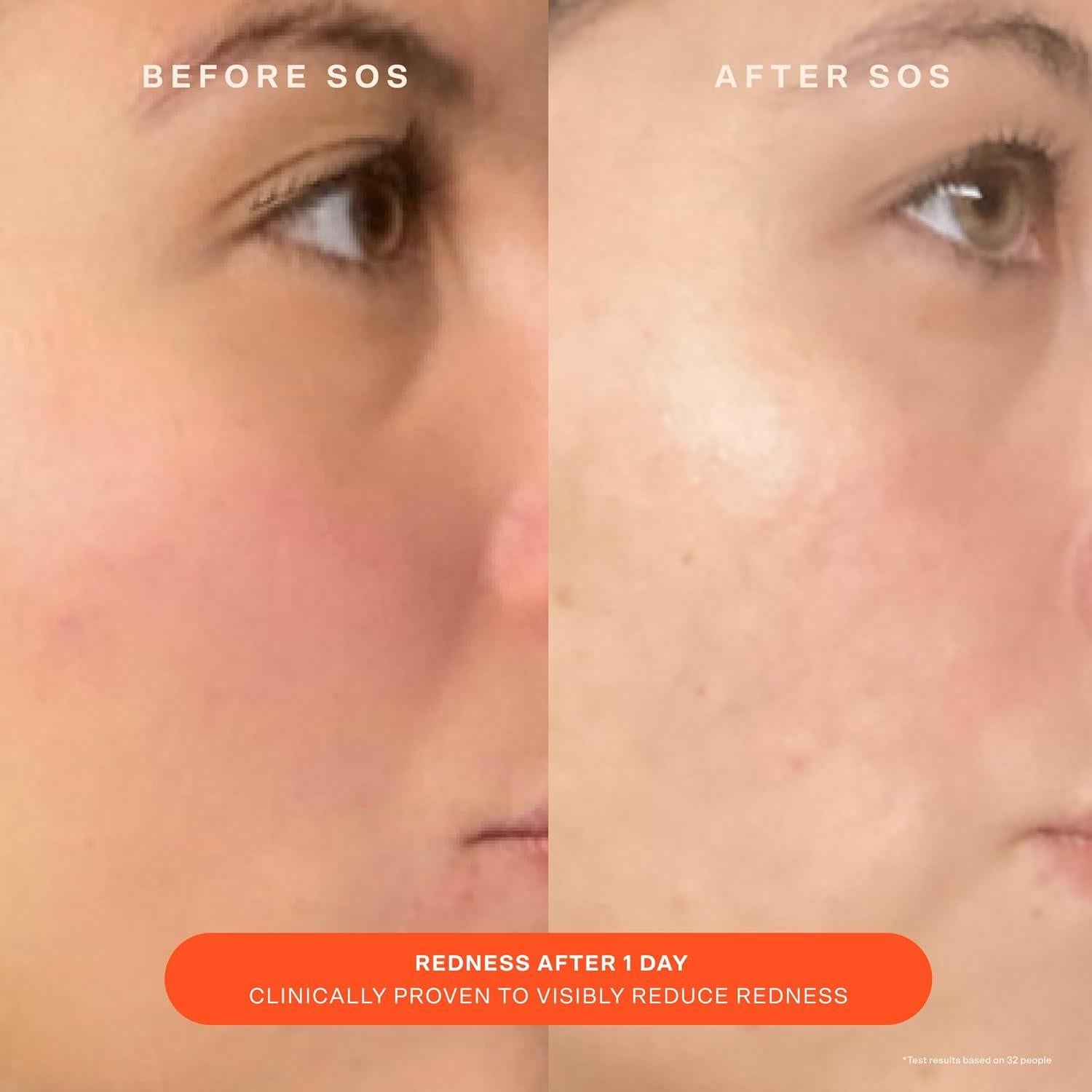 Hidratante Diario Tower 28 Beauty SOS 52.73 g - Piel Sensible