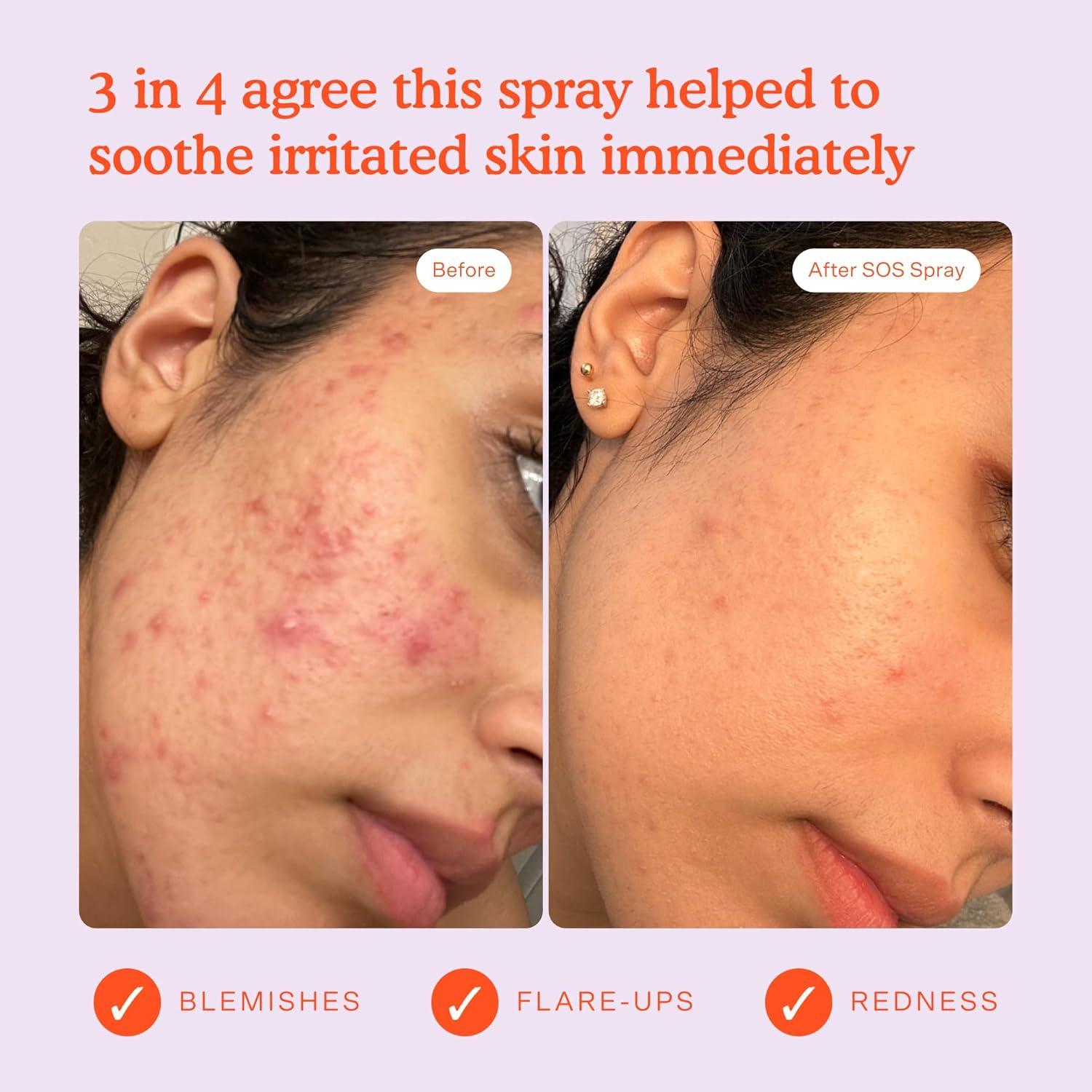 Spray Facial SOS Tower 28 118 ML + Máscara Voluminizadora