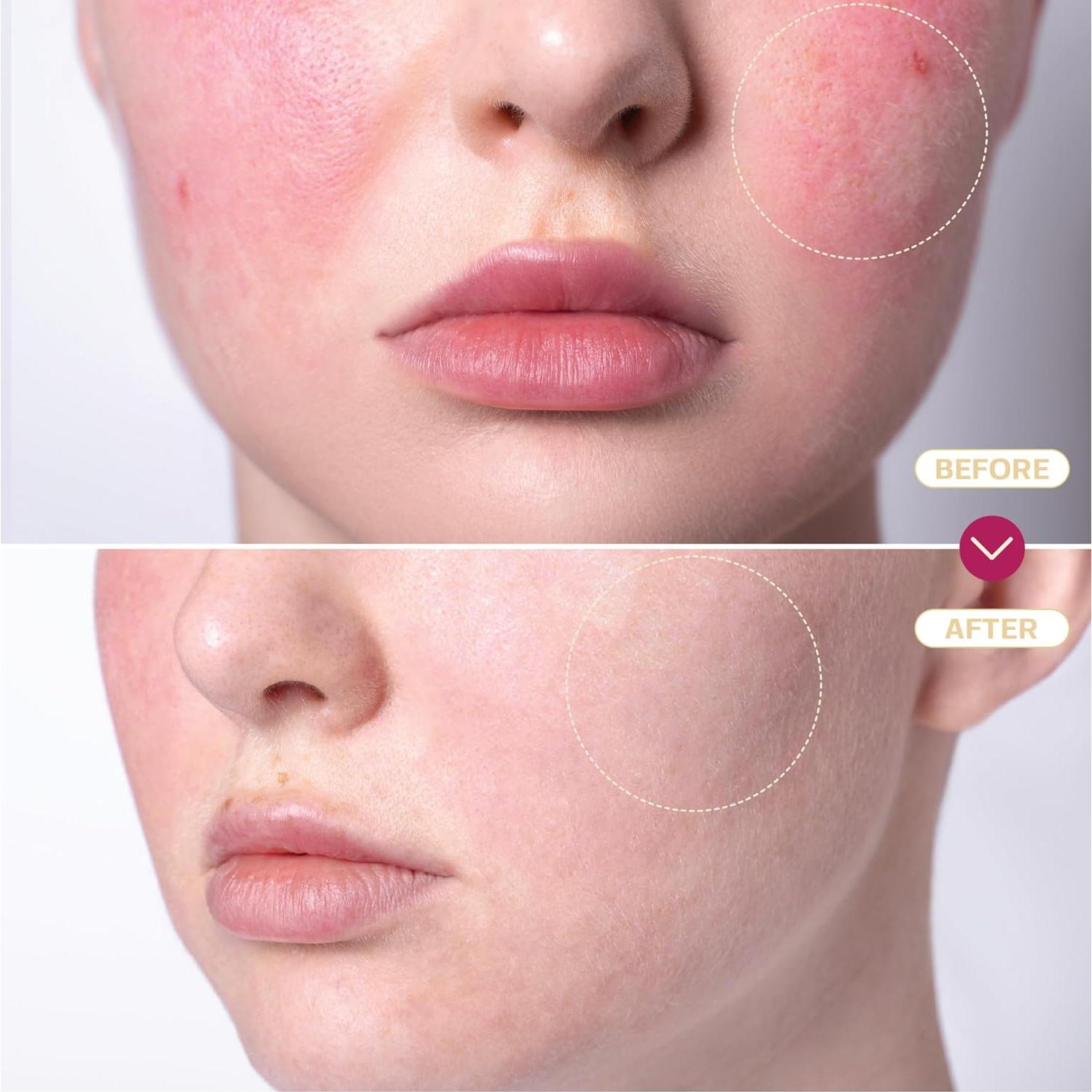 Spray de Ácido Hipocloroso Base Laboratories 236.6 ml - Cuidado Piel