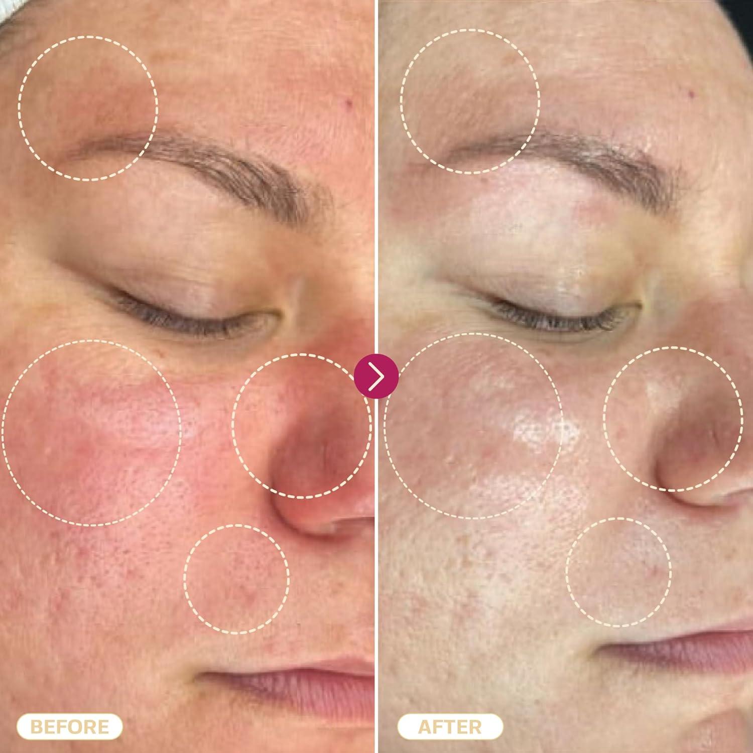 Spray de Ácido Hipocloroso Base Laboratories 236.6 ml - Cuidado Piel