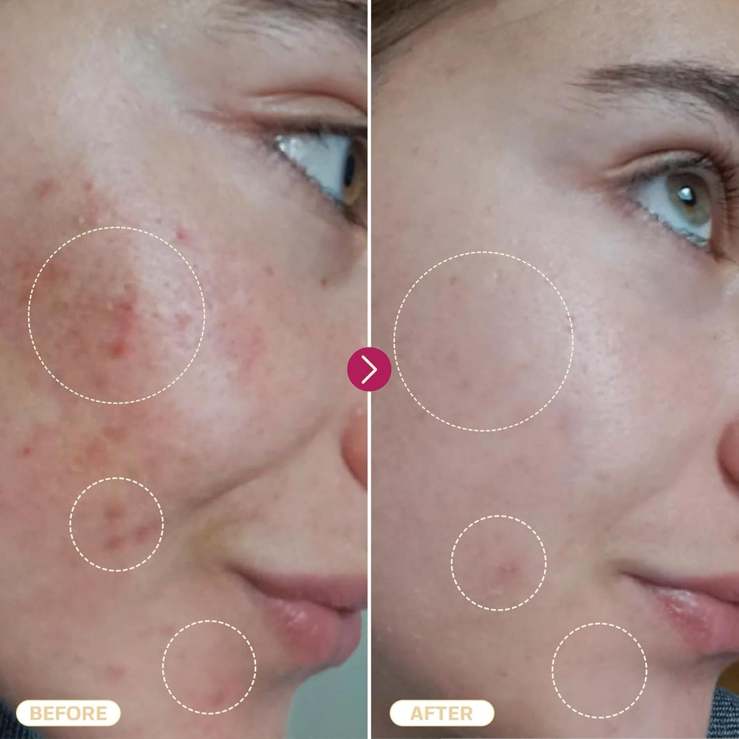 Spray de Ácido Hipocloroso Base Laboratories 236.6 ml - Cuidado Piel