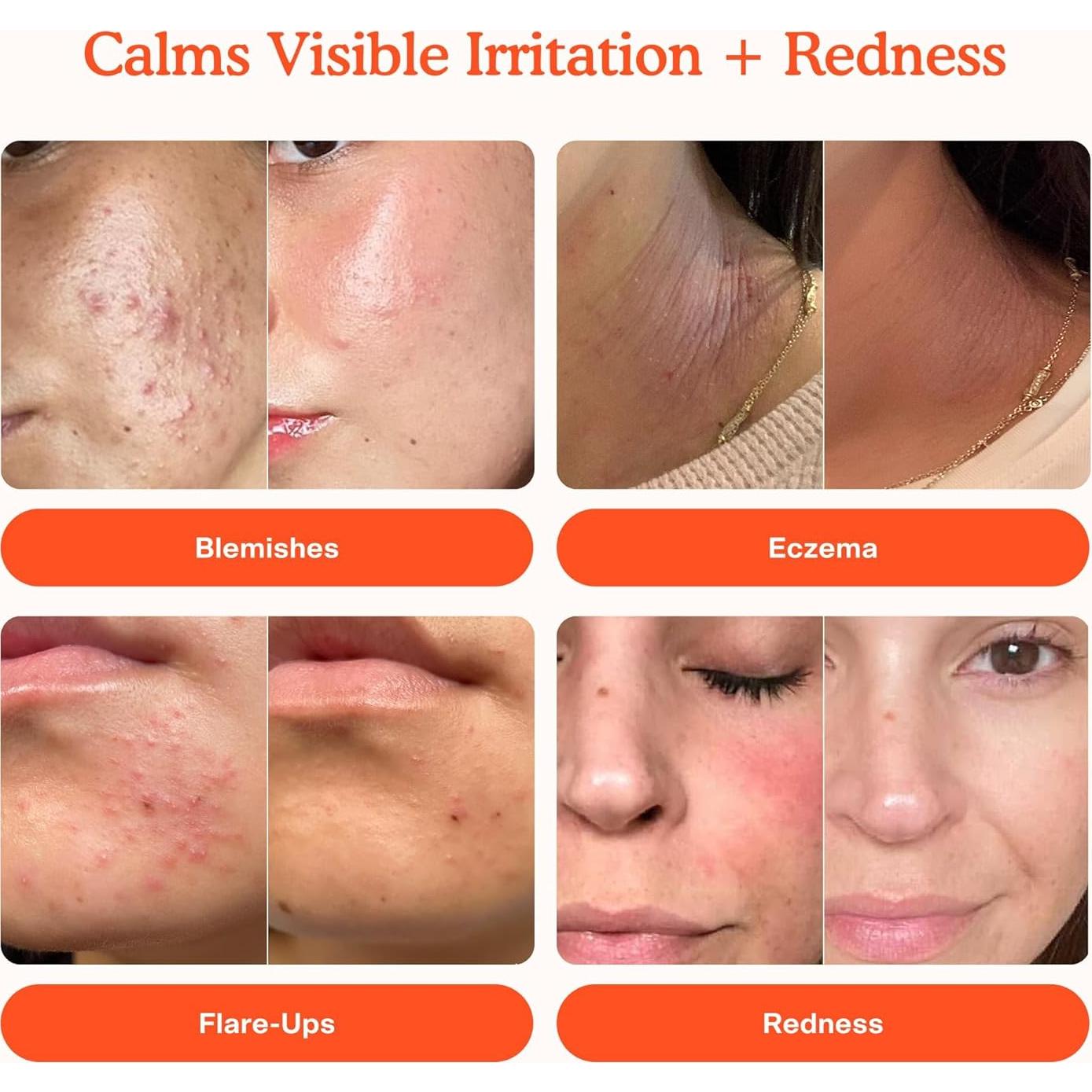 Spray Facial SOS Tower 28 454g y Máscara Voluminizadora