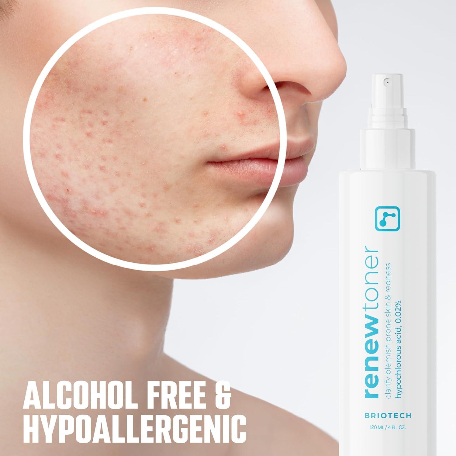 Tónico Facial Briotech Renew 118 ml - Spray de Ácido Hipocloroso