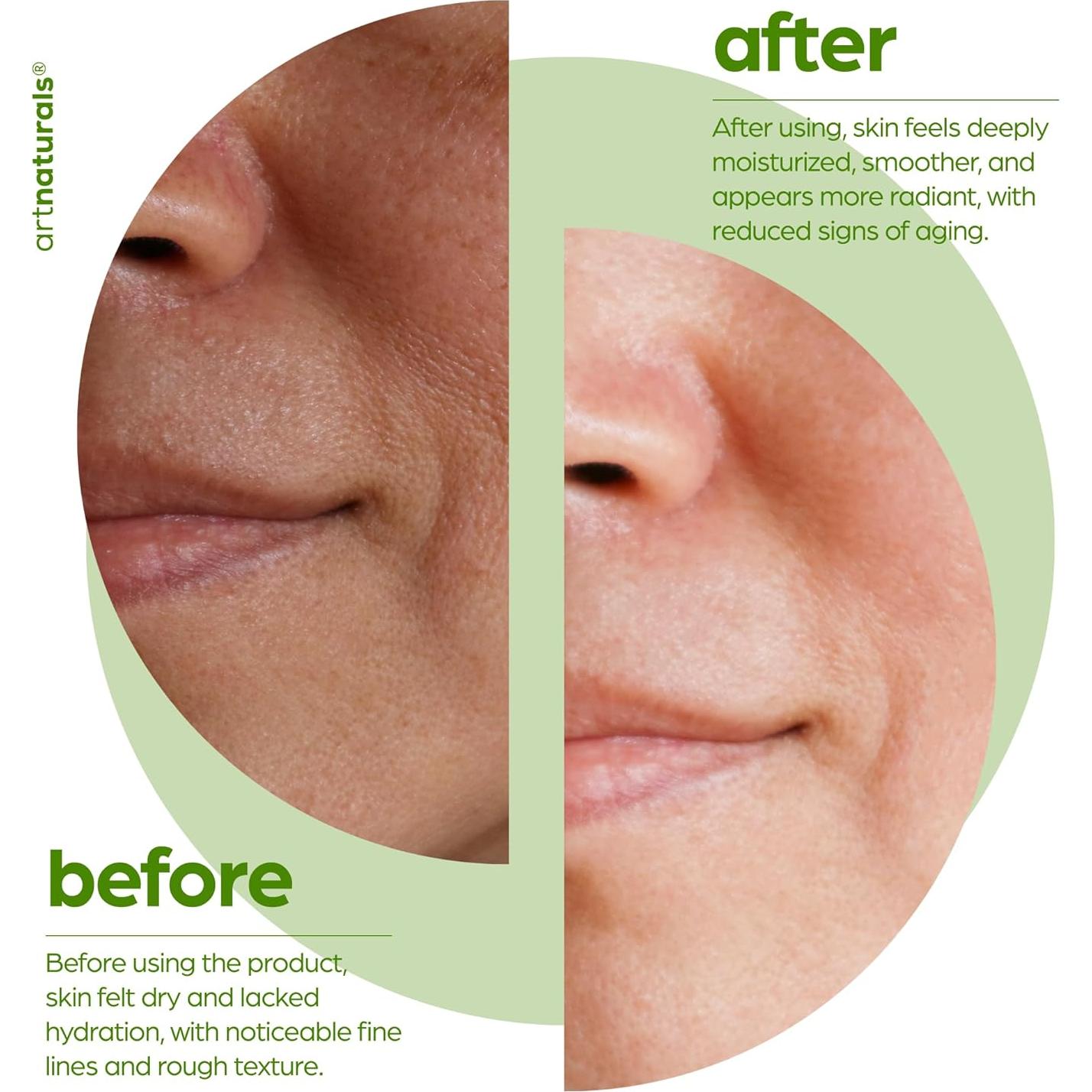 Aceite Facial de Squalano Artnaturals 68 g - Hidratante Vegano